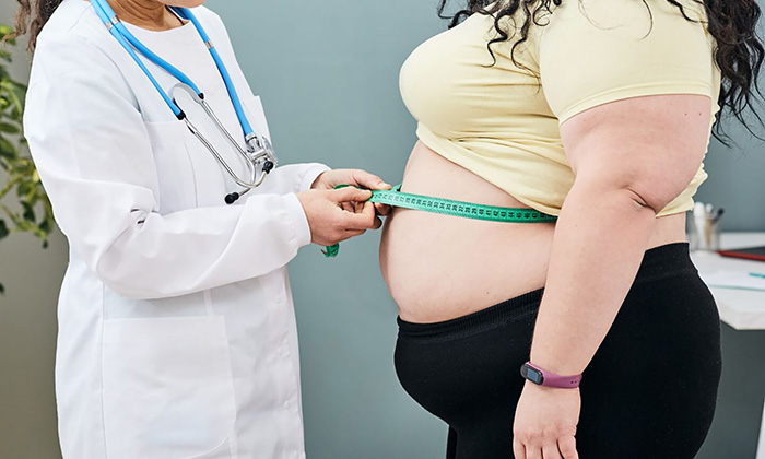 Exhortan a prevenir y atender a tiempo la obesidad; Autoridades de Salud