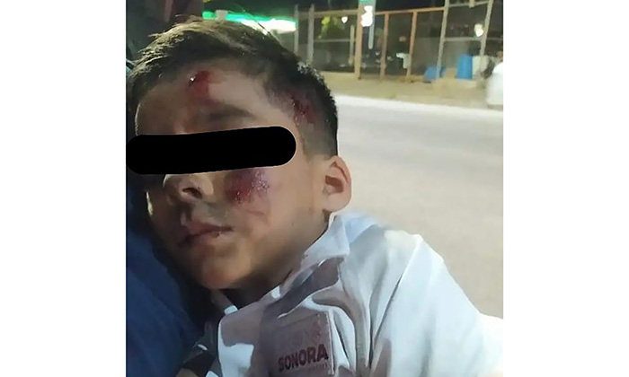 Atropella a niño y se da a la fuga; Es investigado por la FGJE