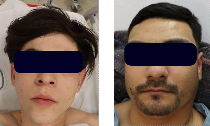 Quedan bajo proceso atacantes de policías