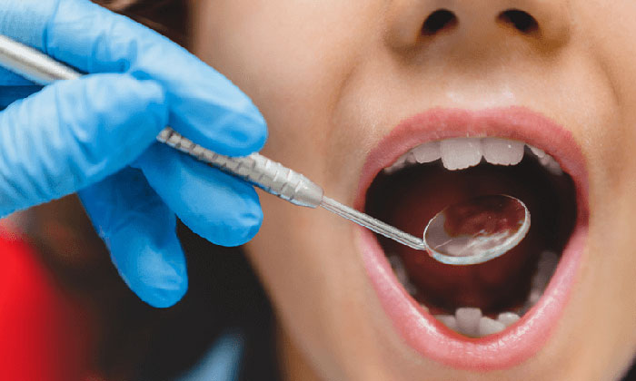 Iniciarán programa de detección de caries a estudiantes; Estudiantes de Odontología de Unison