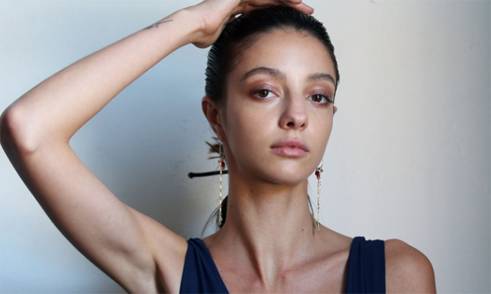 Fallece modelo australiana con malformación arteriovenosa cerebral