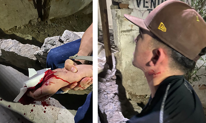 Asaltan y hieren a visitantes del Cerro de la Campana; Un grupo de macheteros