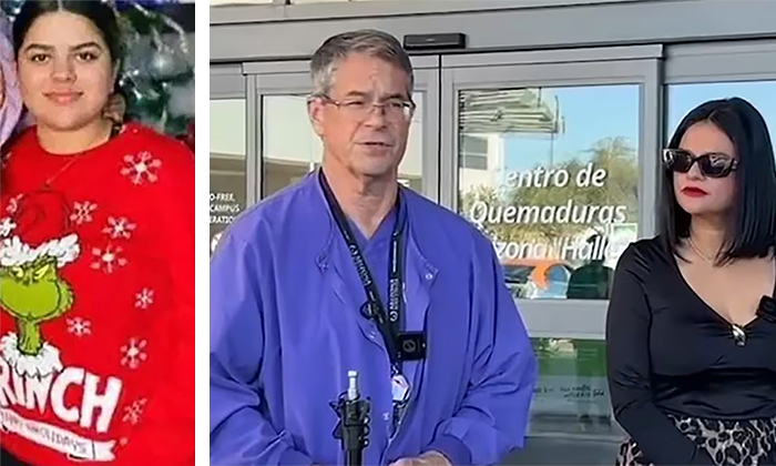 Tiene joven quemada buen pronóstico