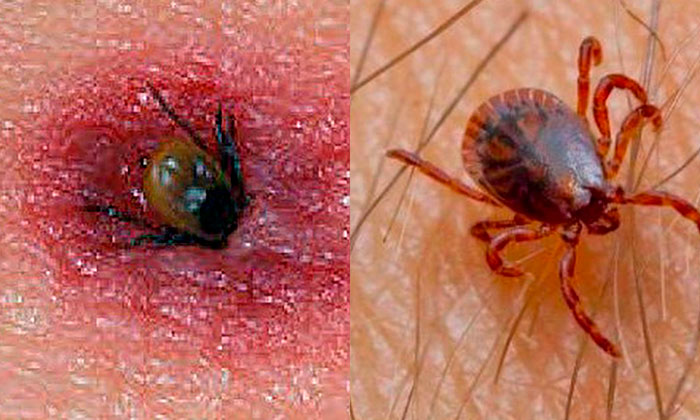 Suman nueve decesos por rickettsia en este año