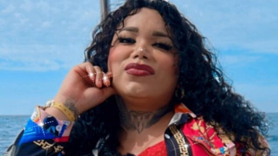 Paola Suárez hospitalizada tras aparatoso accidente