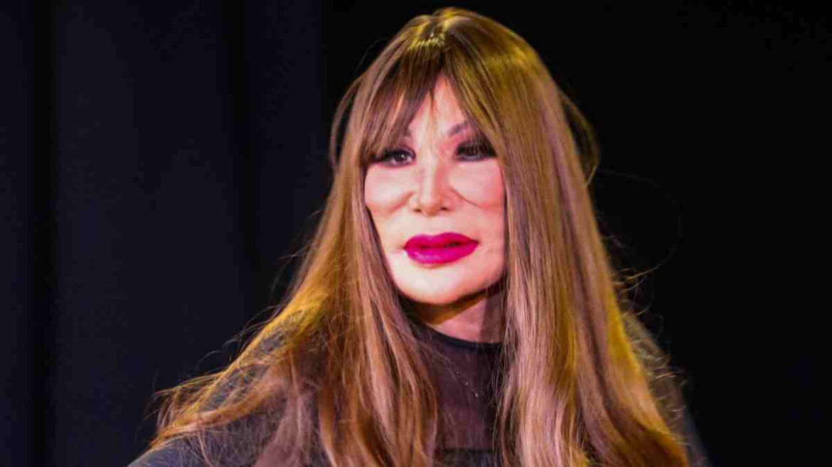 Lyn May habló del procedimiento que cambió su rostro