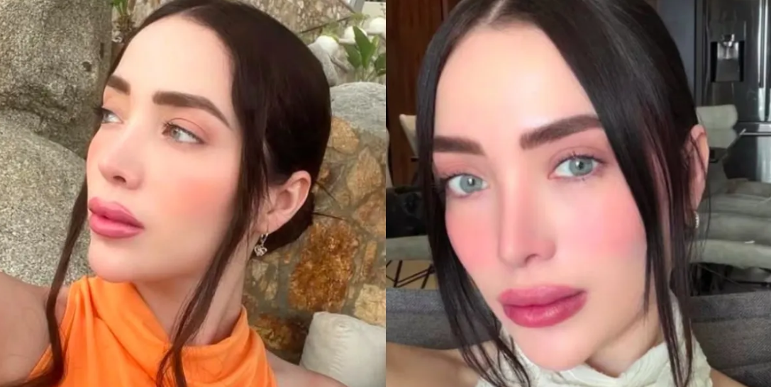 Muere influencer sinaloense tras cirugía estética